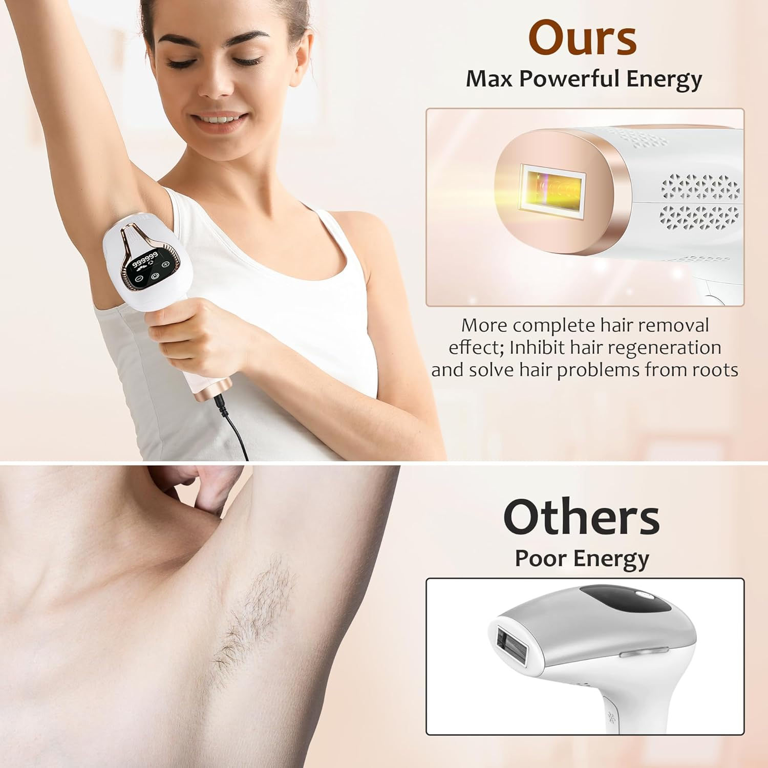 Depilador a laser para remoção - Opt Ipl Laser Hair Removal Machine avaliação e preço