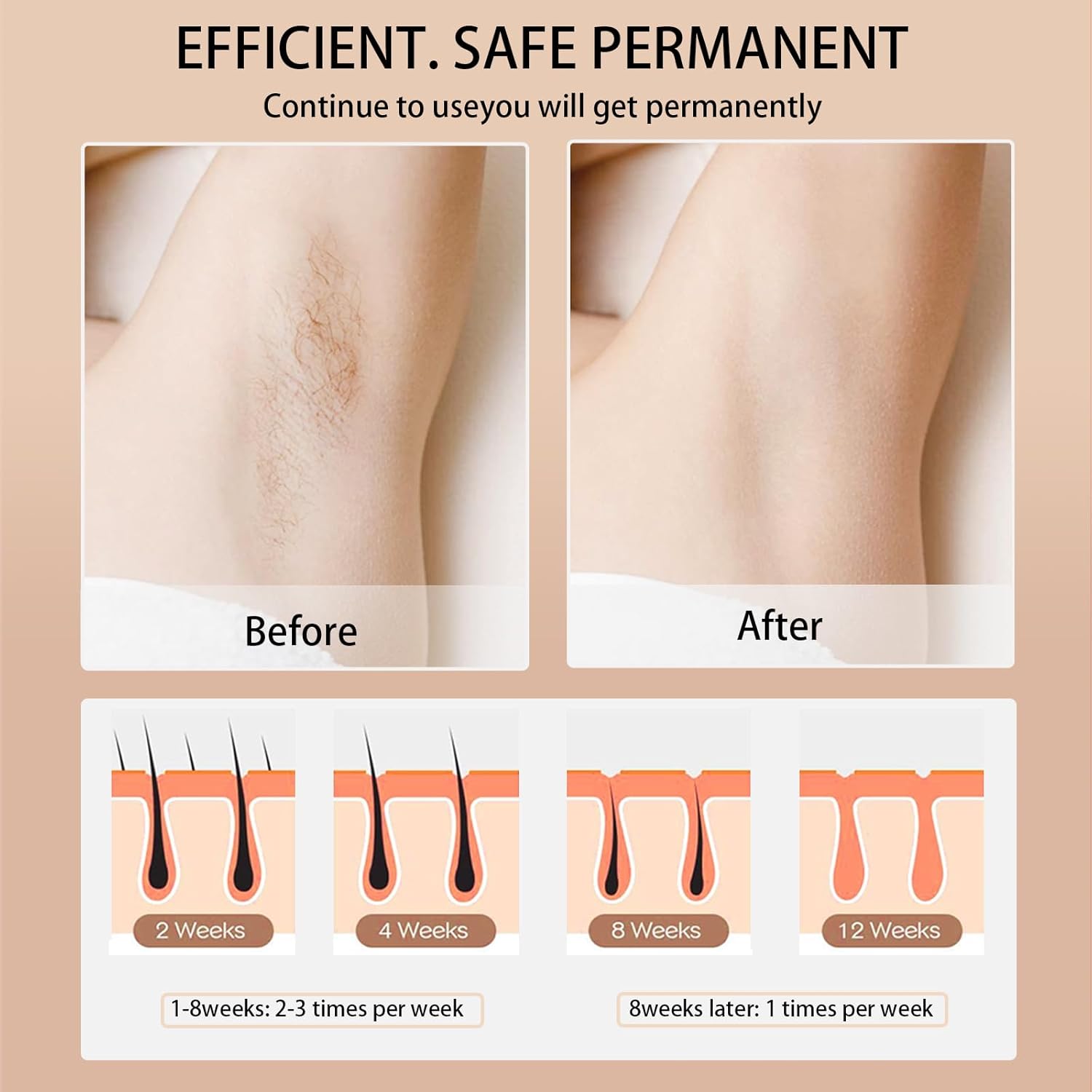 Depilador a laser para remoção - Opt Ipl Laser Hair Removal Machine avaliação e preço