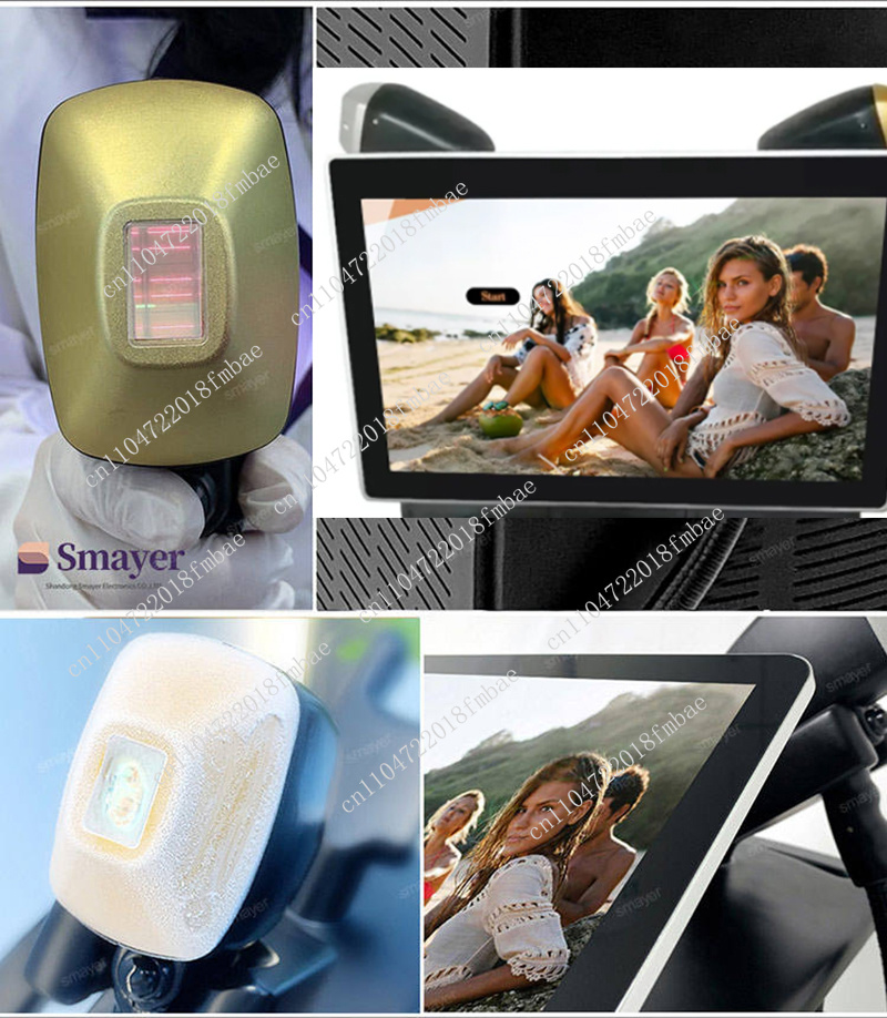 Equipamento de Remoção de Pelo - Diode Laser Hair Removal 808Nm 755Nm 1064Nm avaliação e preço