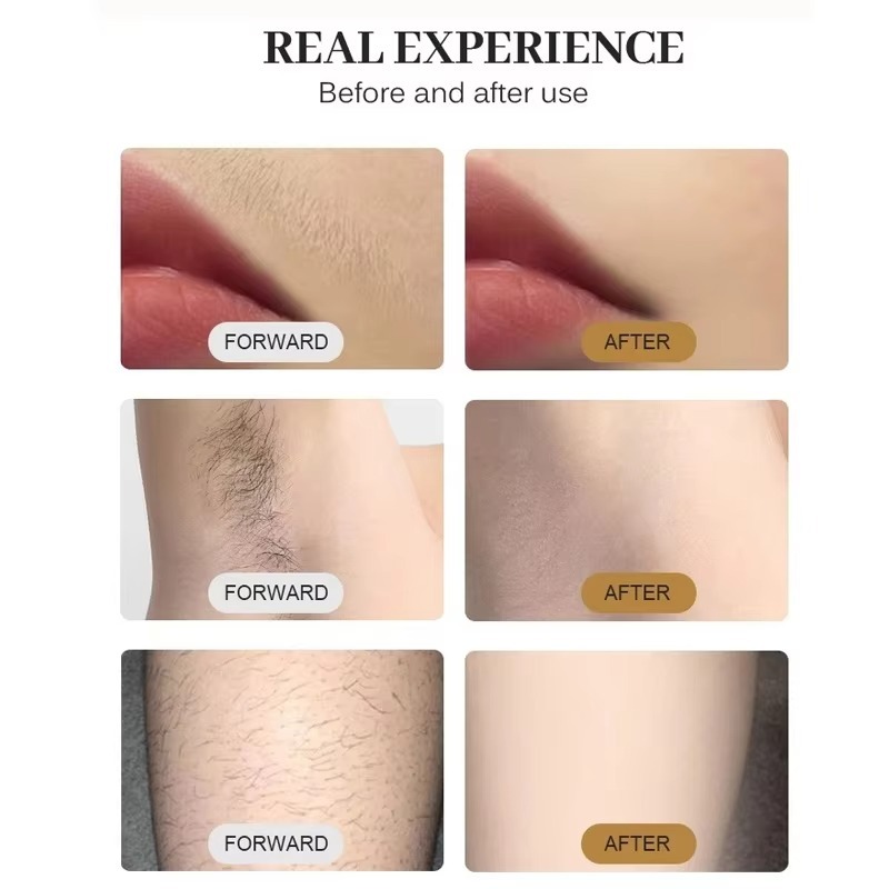 Manípulo para Depilação a Lase - Cooling Gel For Laser Hair Removal avaliação e preço
