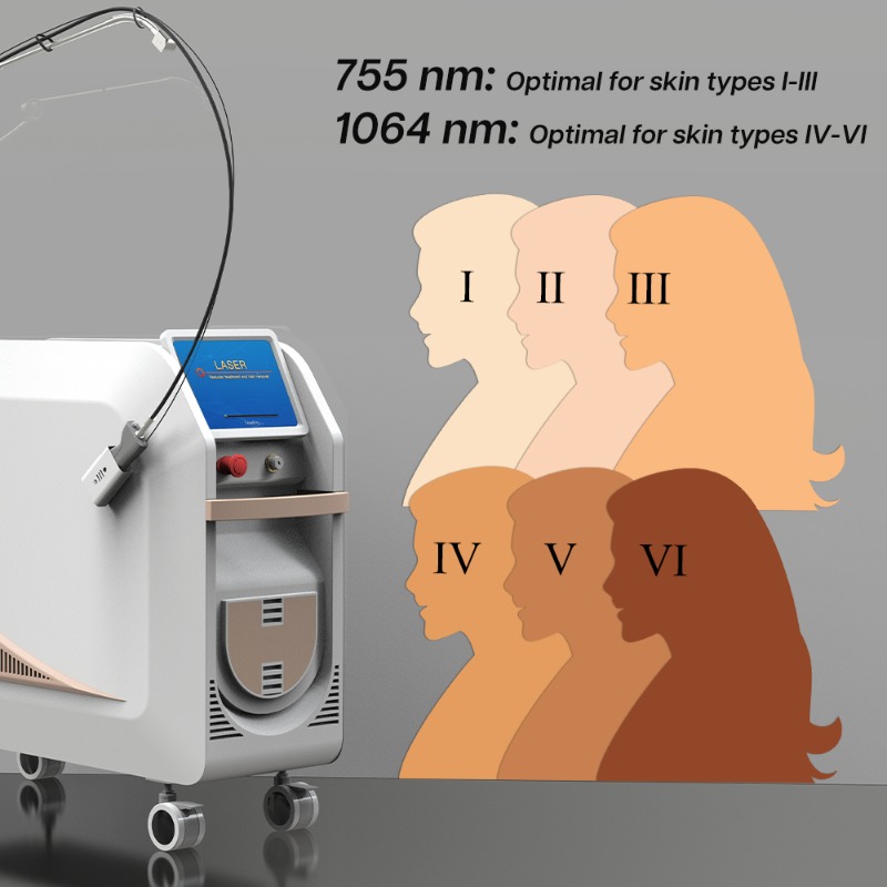 Máquina de Depilação a Laser N - Alexandrite Laser Hair Removal Machine avaliação e preço