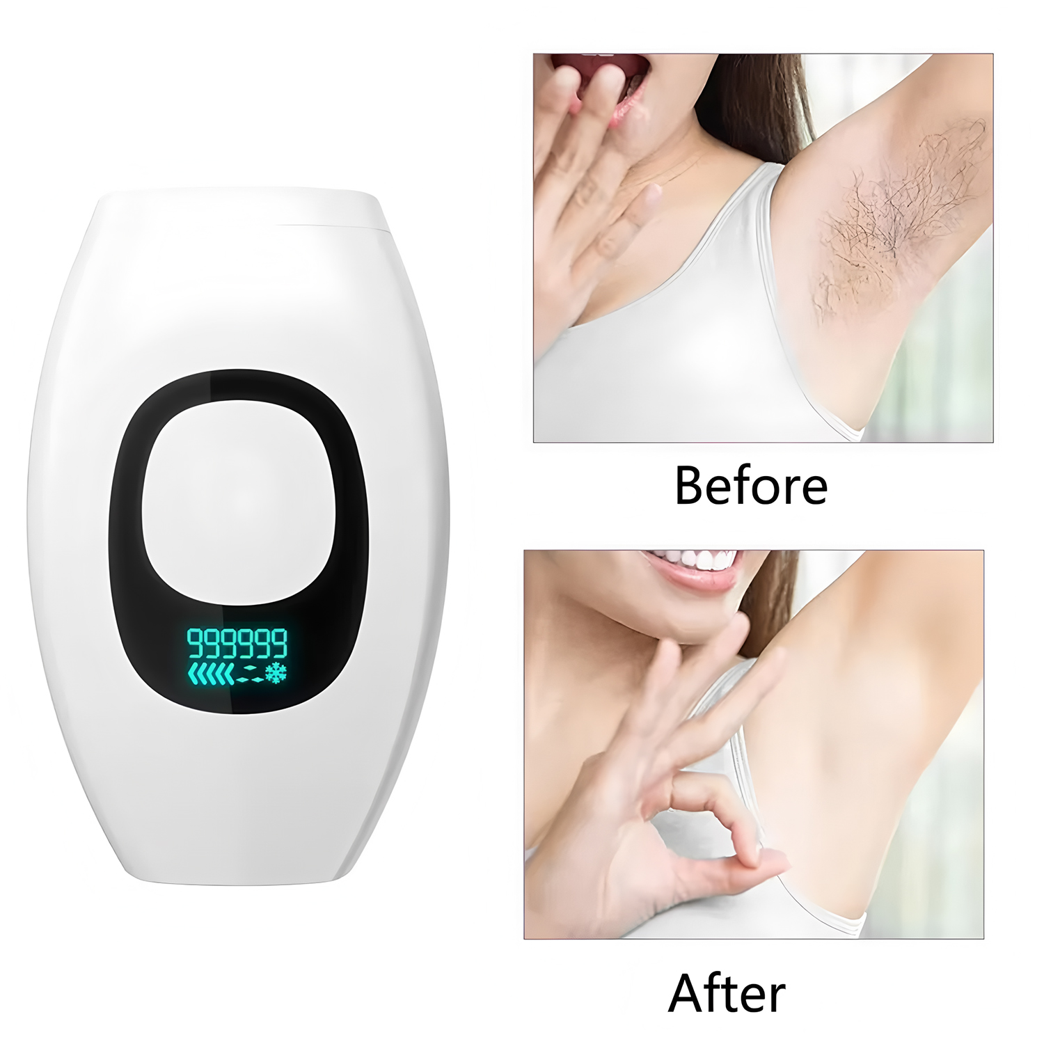 Depilador IPL com Display Digi - Opt Ipl Laser Hair Removal Machine avaliação e preço