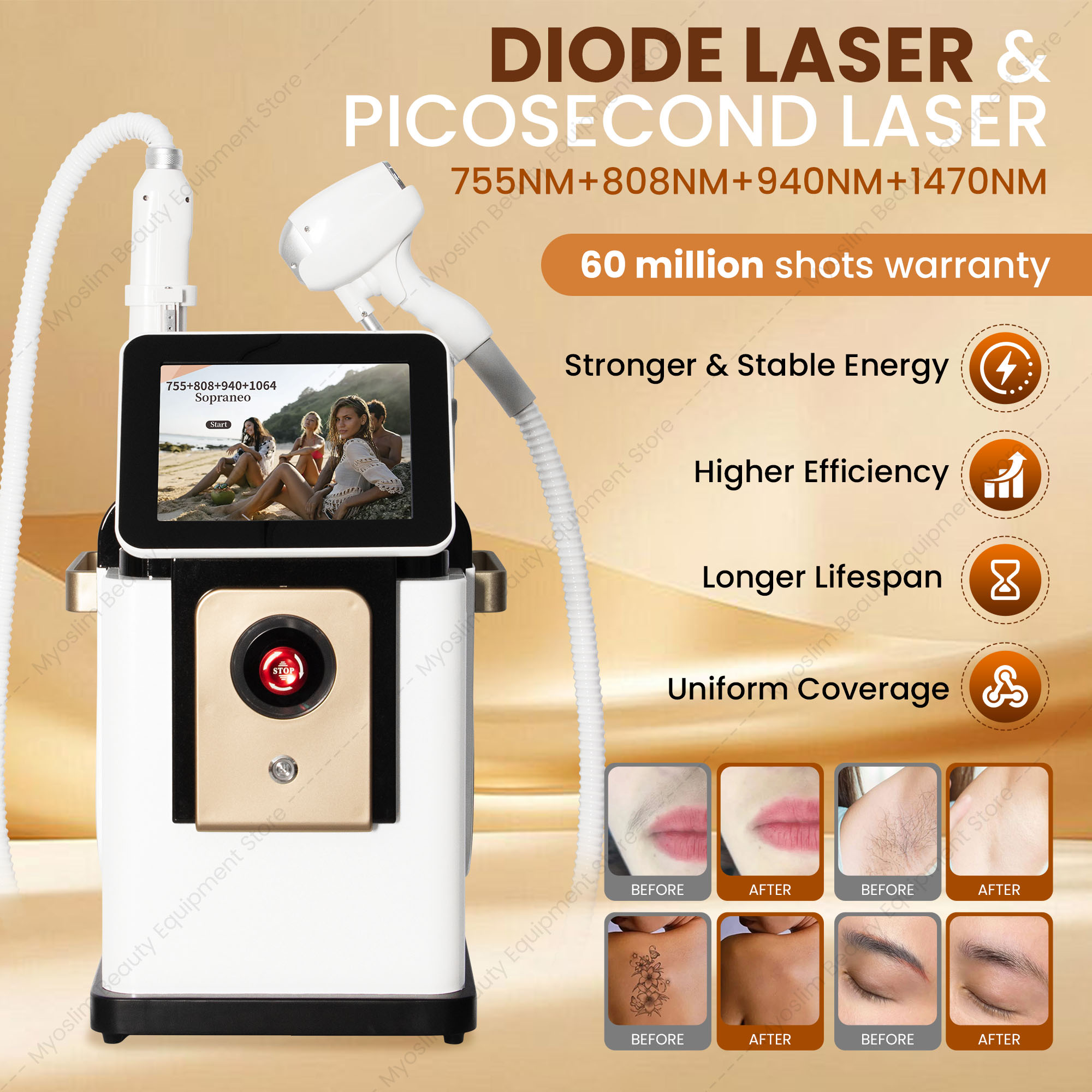Dispositivo de Depilação a Las - Diode Laser Hair Removal 808Nm 755Nm 1064Nm avaliação e preço