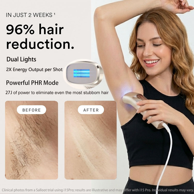 Dispositivo de Remoção de Cabe - Home Ipl Hair Removal Sapphire Cooling avaliação e preço