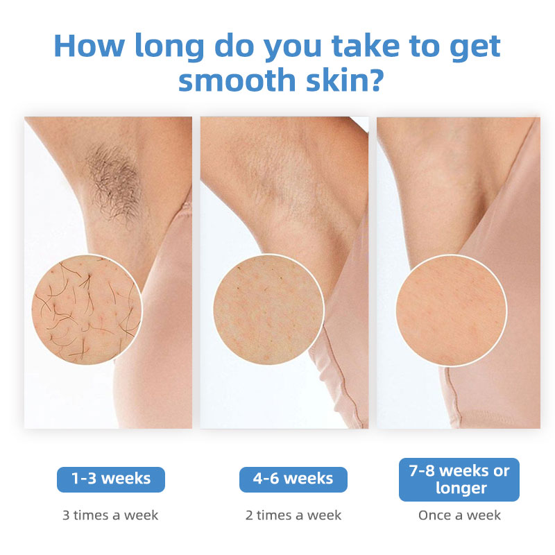 IShine Sapphire Ice Cooling IP - Home Ipl Hair Removal Sapphire Cooling avaliação e preço