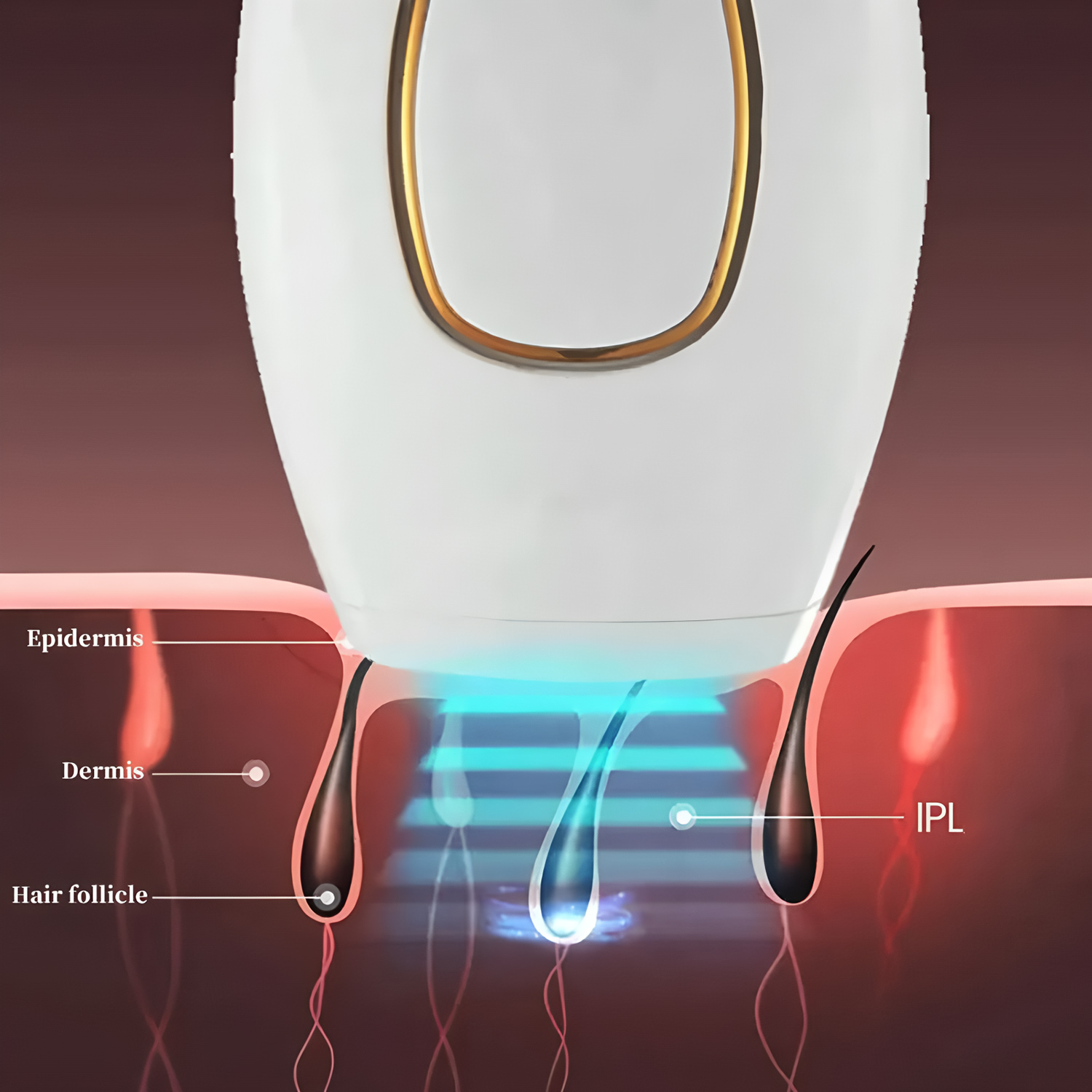 Depilador a laser IPL para rem - Opt Ipl Laser Hair Removal Machine avaliação e preço